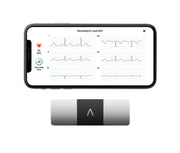 KardiaMobile 6-Lead Personal EKG Monitor – Six Views of The Heart – Detects AFib and Irregular Arrhythmias – Instant Results in 30 Seconds – Works with Most Smartphones