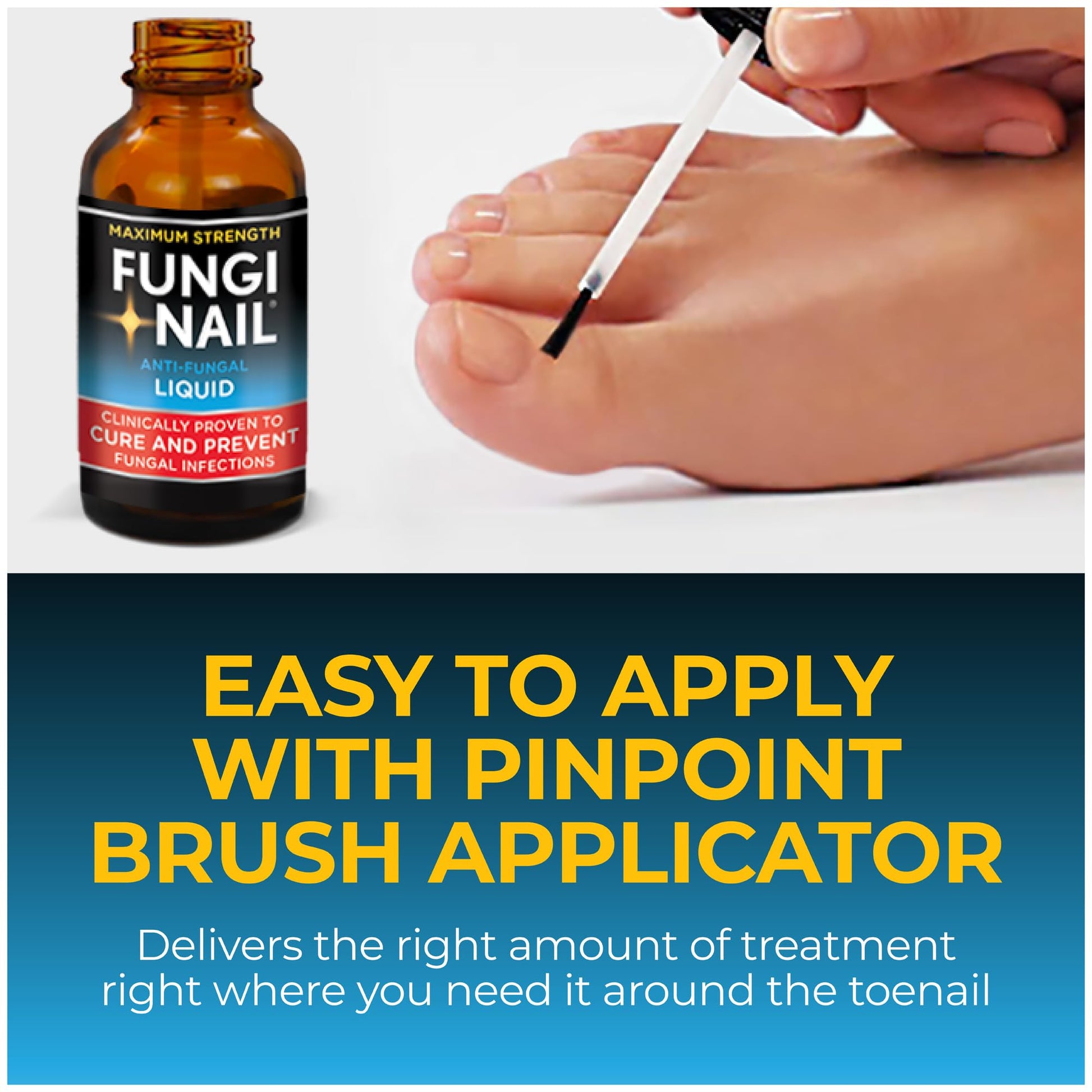 Fungi-Nail Anti-Fungal Liquid Solution, Kills Fungus That Can Lead to Nail & Athlete's Foot with Tolnaftate & Clinically Proven to Cure and Prevent Fungal Infections 1 Fl Oz (Pack of 1)