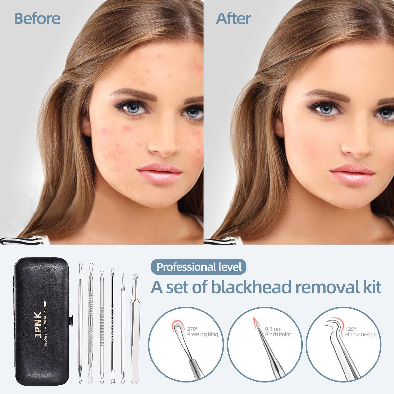 JPNK Blackhead Remover Comedone Extractor Acne Removal Kit..