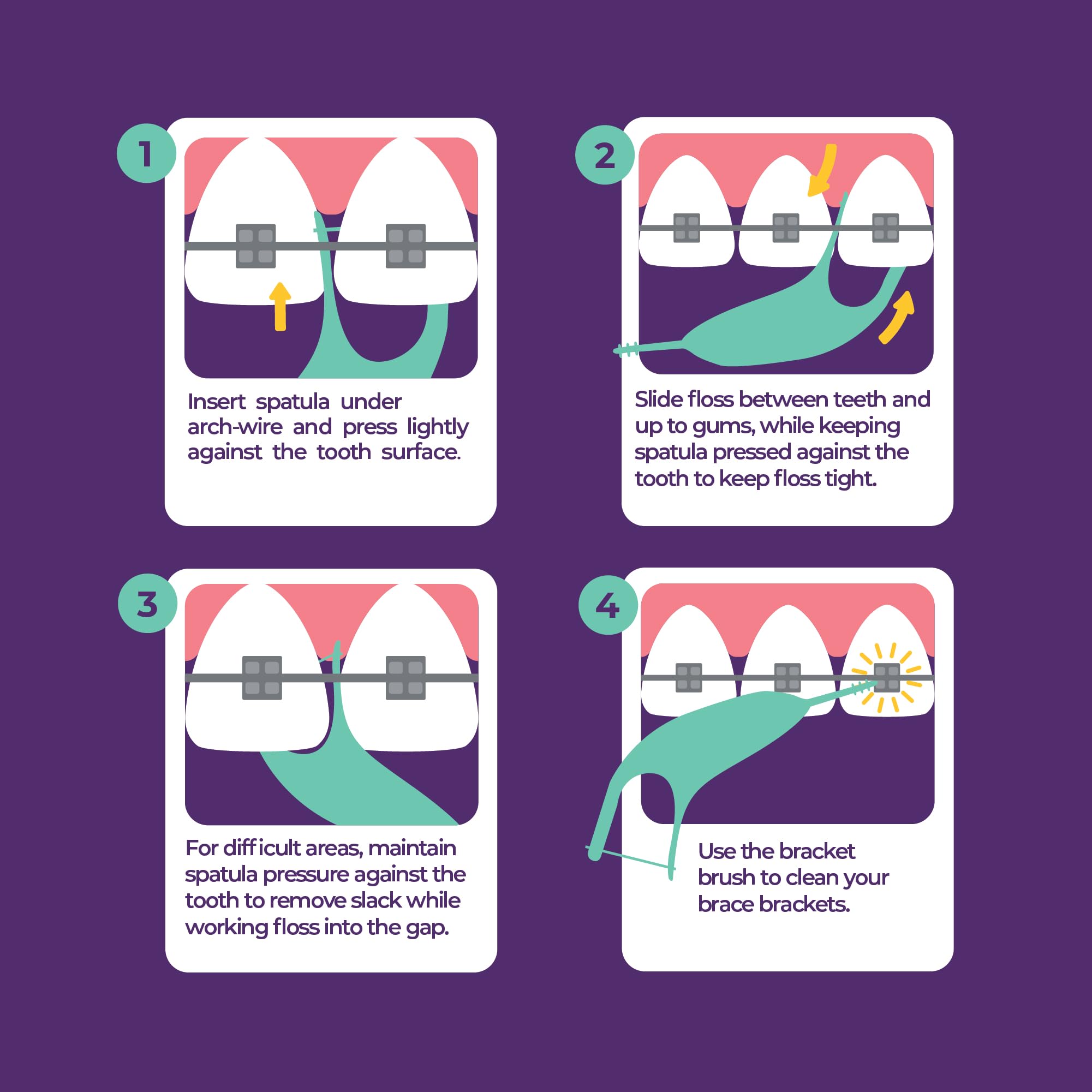 Platypus Orthodontic Flossers for Braces, 40 Count (Pack of 1), Ortho Picks for Adults & Kids, Fits Under Arch Wire, Non-Damaging, Encourage Flossing Habits