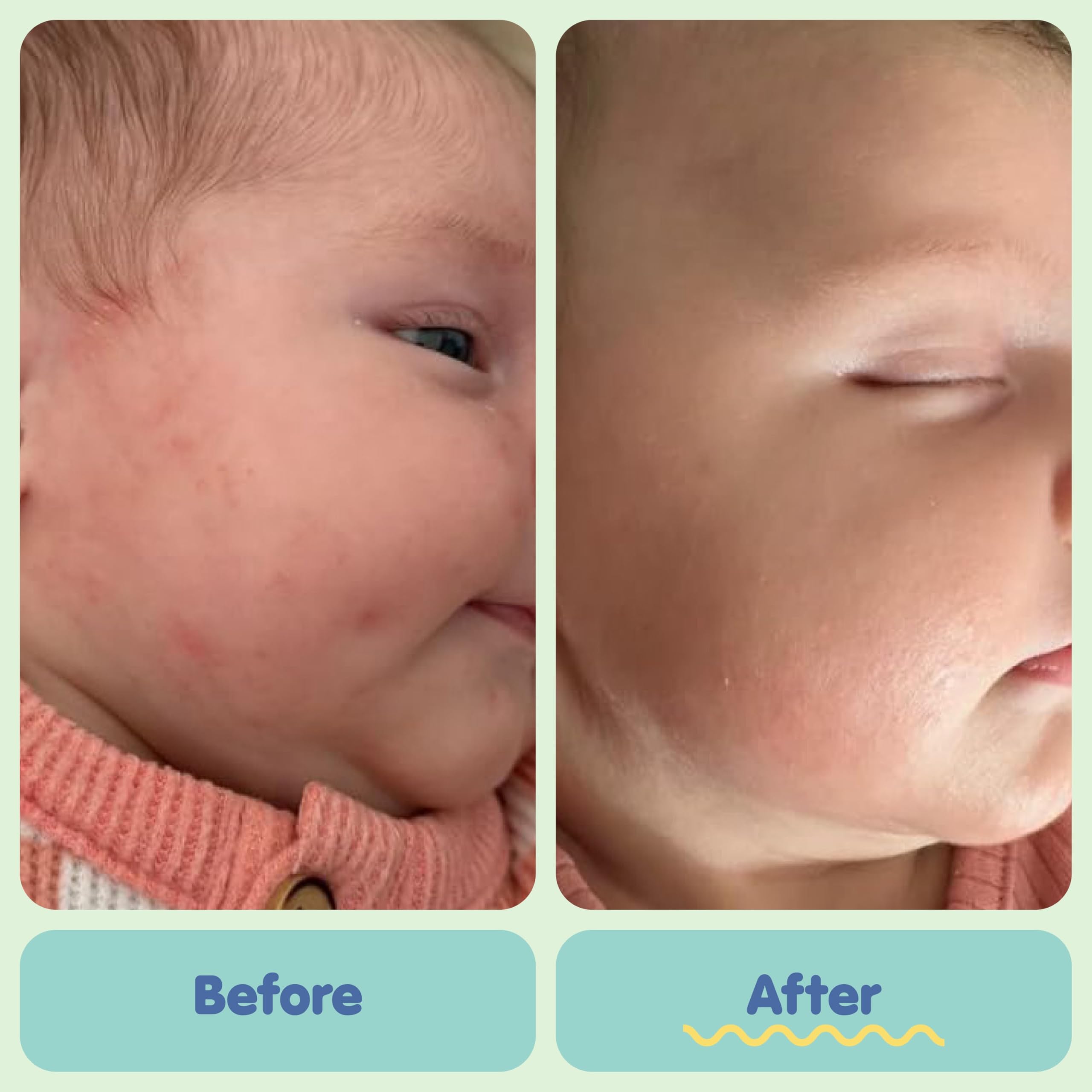TUBBY TODD All Over Ointment - Baby Eczema Cream - Everyday Multi-Purpose Baby Skin Relief Cream - Sensitive Skin, Dry Skin & Irritation - Steroid & Gluten Free - Fragrance Free, 2 Pack 3.5oz & 8oz