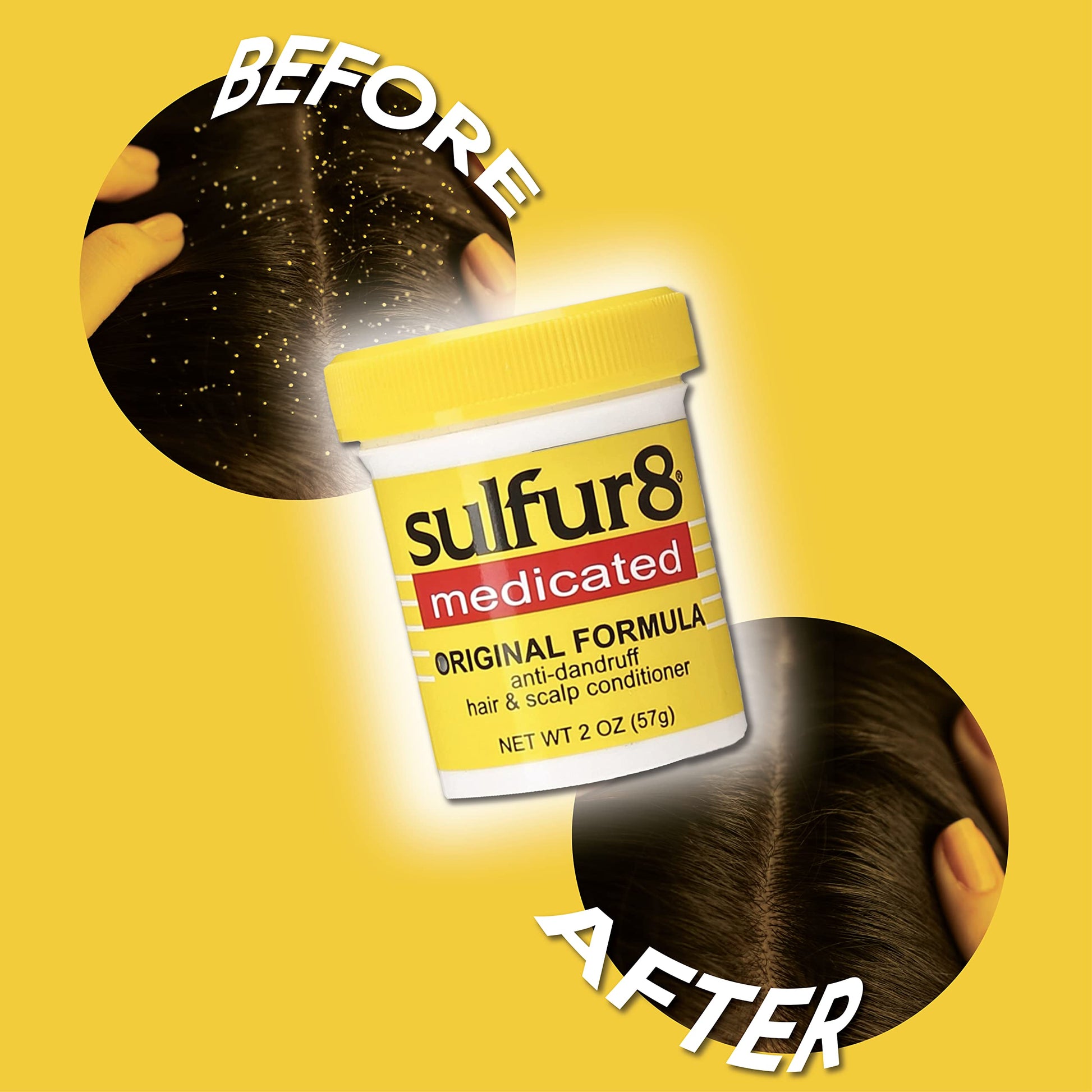 Sulfur8 Medicated Original Formula Anti-Dandruff Hair & Scalp Conditioner, 2 OZ - 2 Pack